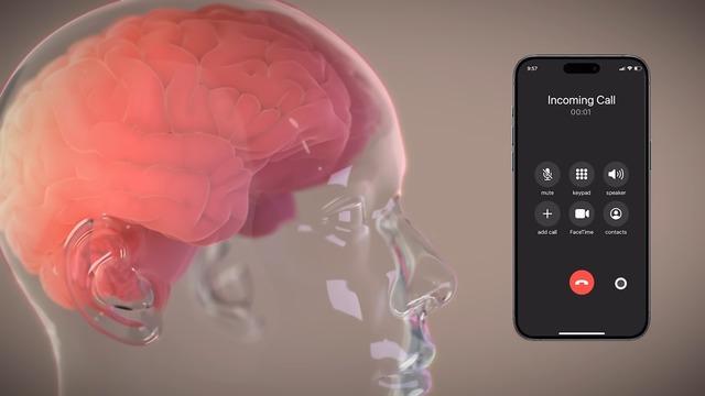 Neuralink'in Tarihe Geçecek Deneyi Ortaya Çıktı: Beyin Sinyalleriyle İletişim Kurulabilecek!